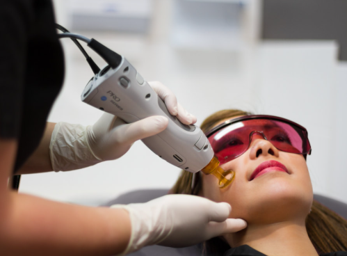 Laser dermatologique